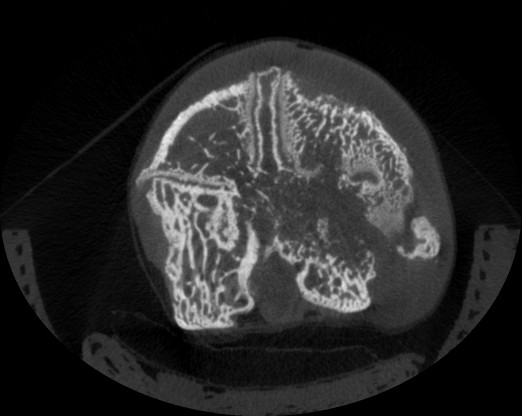 横断面切片